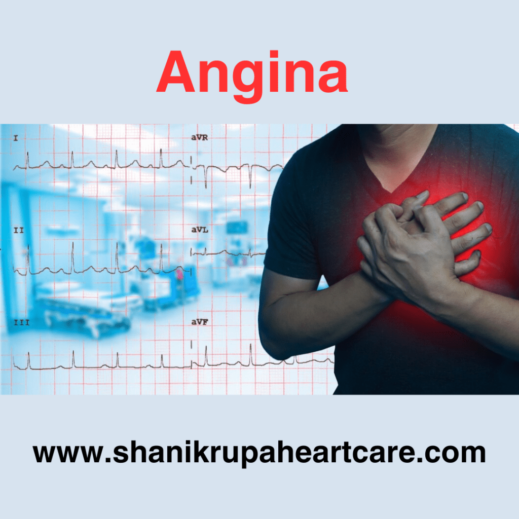 angina