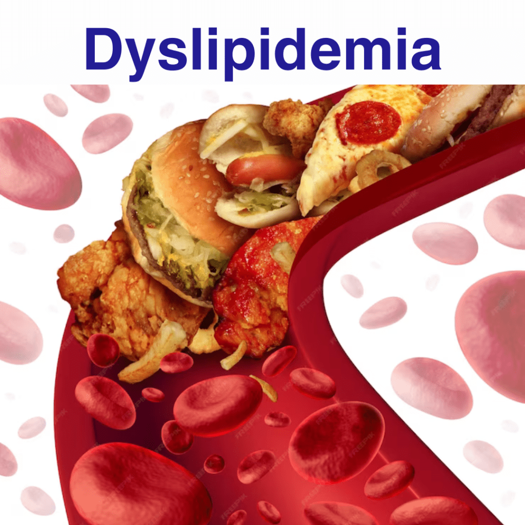 dyslipidemia