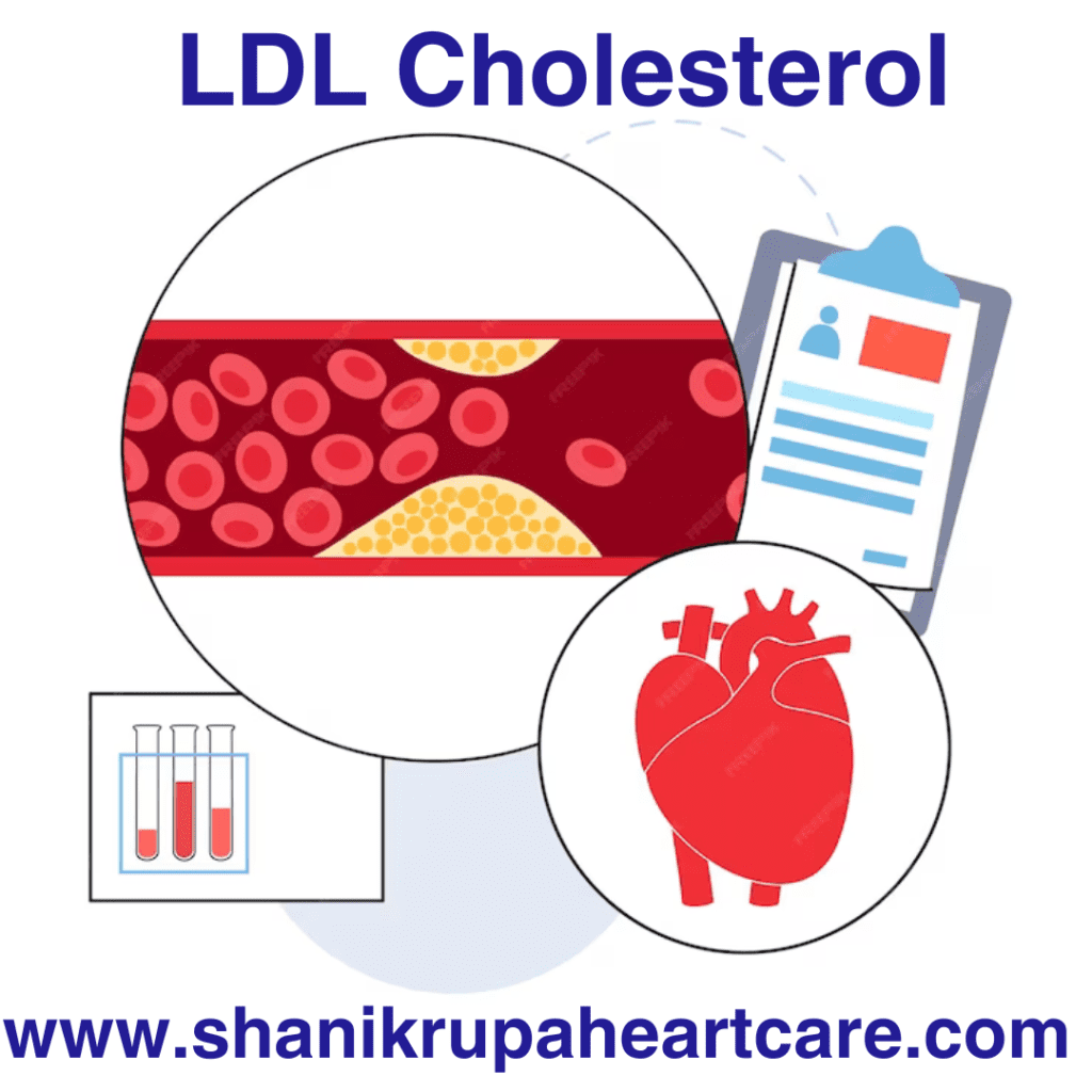 ldl cholesterol