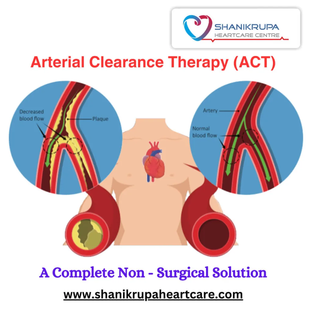 Artery clearance therapy (ACT)