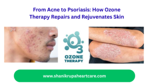 Ozone therapy in Pune