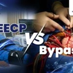 EECP Vs Bypass