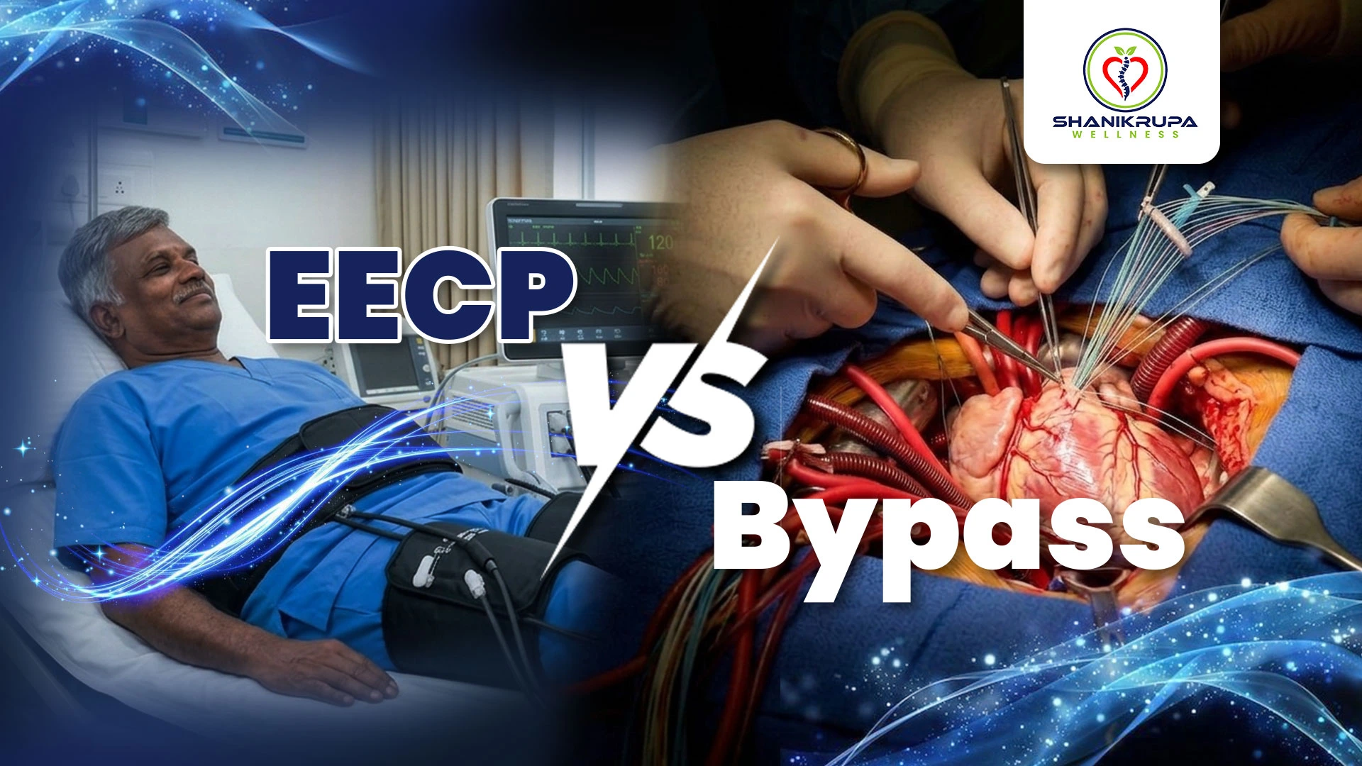 EECP vs. Bypass Surgery: Is There a Safer Path to Heart Health?